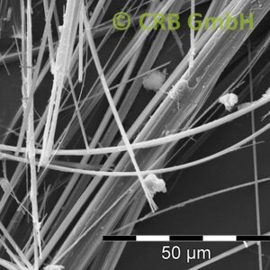 REM-Bild Aktinolith | © © CRB Analyse Service GmbH